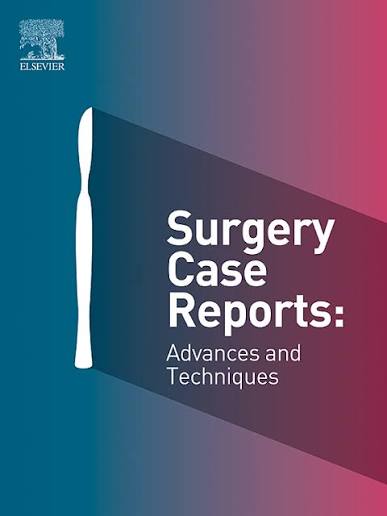 Cecal endometriosis presenting as acute appendicitis/ژورنال Case Reports in Surgery