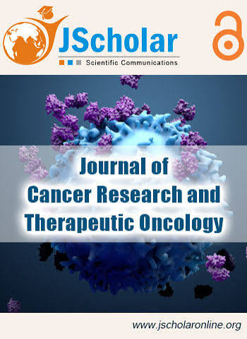 Primary breast angiosarcoma associated with abnormalities in international normalized ratio platelet count and anemia/ژورنال Journal of Cancer Research and Therapeutics
